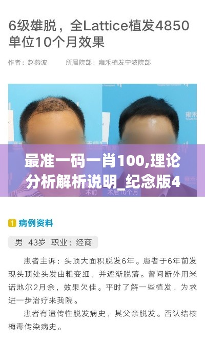 最准一码一肖100,理论分析解析说明_纪念版4.850