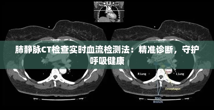 肺静脉CT检查实时血流检测法：精准诊断，守护呼吸健康