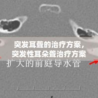 突发耳聋的治疗方案，突发性耳朵聋治疗方案 
