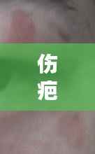 伤疤不断脱落，伤疤不小心脱落怎么办 