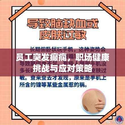 员工突发癫痫，职场健康挑战与应对策略