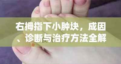 右拇指下小肿块，成因、诊断与治疗方法全解析