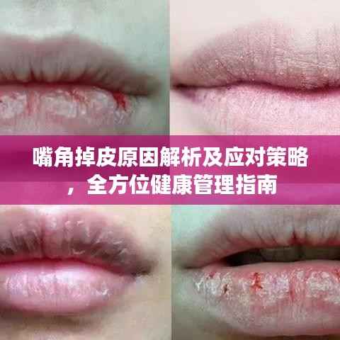 嘴角掉皮原因解析及应对策略，全方位健康管理指南
