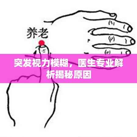 突发视力模糊，医生专业解析揭秘原因
