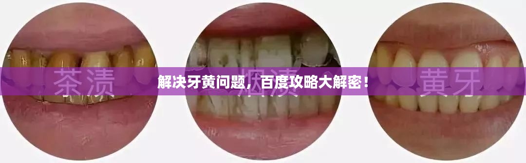 解决牙黄问题，百度攻略大解密！