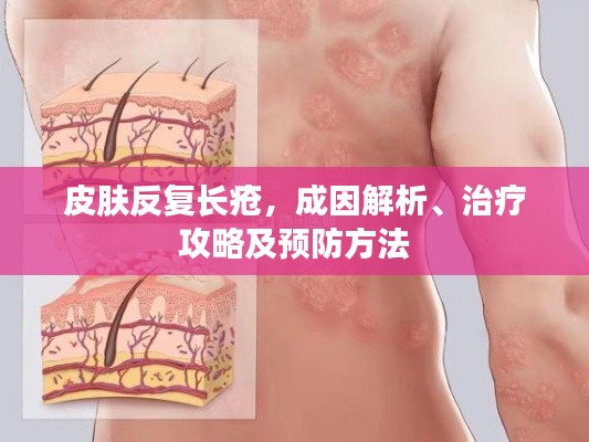 皮肤反复长疮，成因解析、治疗攻略及预防方法